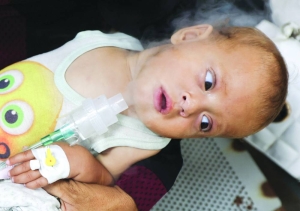 ‘Polio could claim more lives than Israeli war’