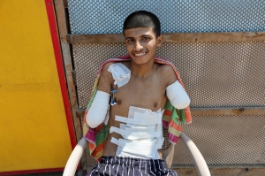 Gaza teen amputee recalls nightmare of losing arms in Israeli strike