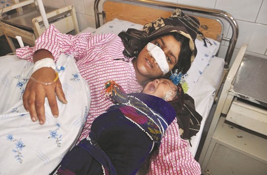 Afghan woman Reza Gul, 20, whose nose was sliced off by her husband in an attack, lies on a bed with her baby as she receives treatment at a hospital in the northern province of Faryab yesterday.