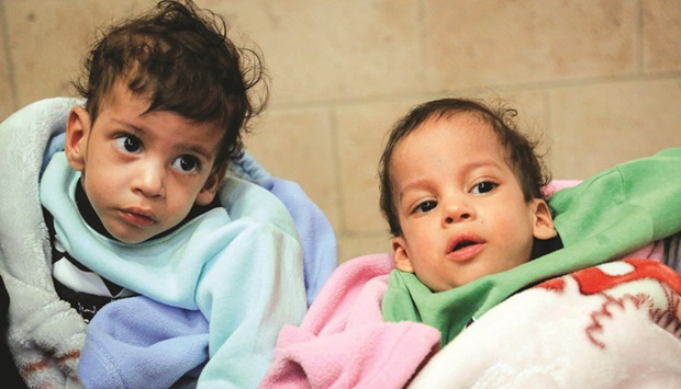 A handout picture released by the United Nations childrenu2019s agency Unicef shows conjoined twins Mohamed and Ahmed shortly after arriving at the Yemeni capital Sanaa.