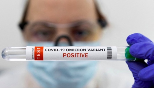 Test tube labelled ,Covid-19 Omicron variant test positive, is seen in this illustration picture taken January 15, 2022.