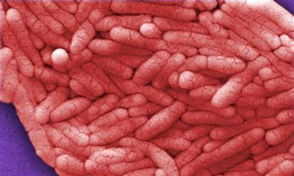 Under a very high magnification of 12000X, this colourised scanning electron micrograph shows a large grouping of Gram-negative Salmonella bacteria.